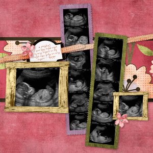 Katy's 16 week Ultrasound