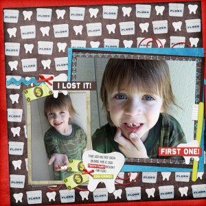 Lost Tooth