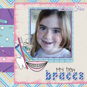 braces_mily