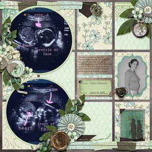 fiona ultrasound
