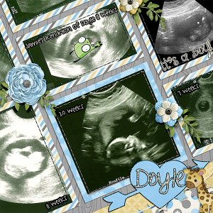 doyle-ultrasounds