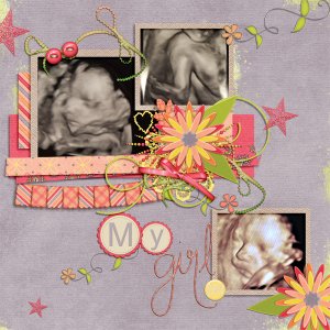 Sonogram- july 13
