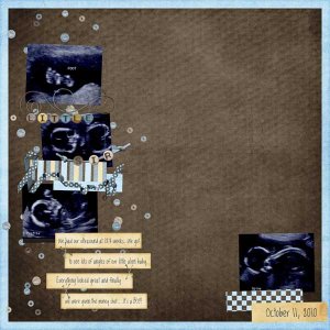 Ultrasound