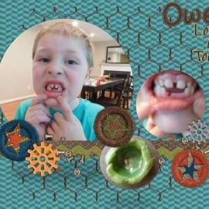 Owen Loses a Tooth - July 2016 Template #2 Challenge
