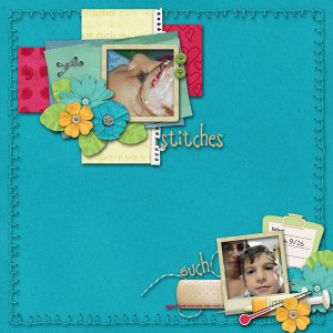 stitches