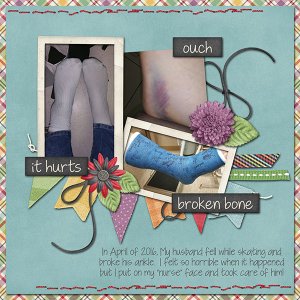 Broken Bone