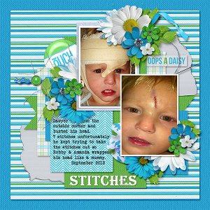 Stitches