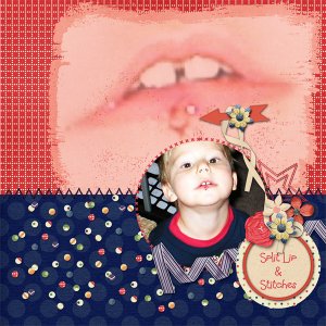 Split Lip + Stitches