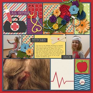 Stitches