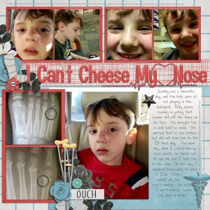 I Cant Cheese My Nose is Broke