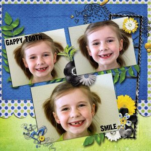 Gappy Tooth Smile