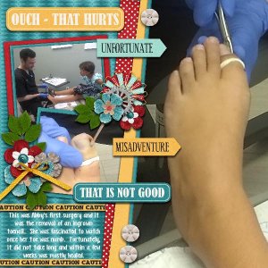 Oh No, My Toe!