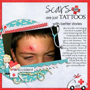 Scars