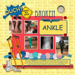 Broken Ankle