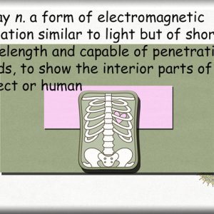 X is for X-Ray