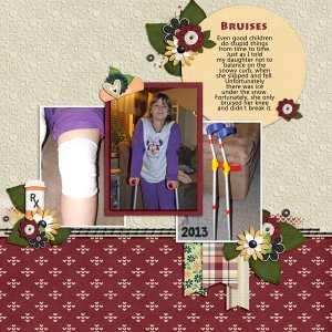 bruises 2013