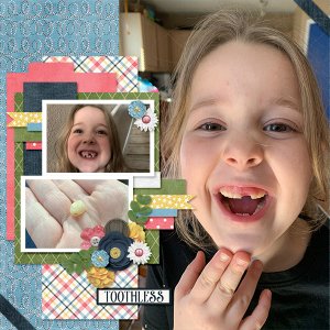Lost Tooth