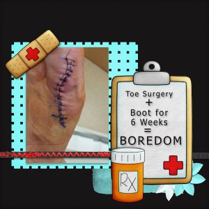 Toe Surgery