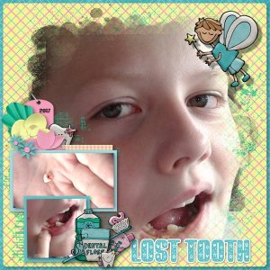 Lost Tooth