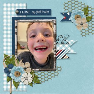 I Lost My First Tooth