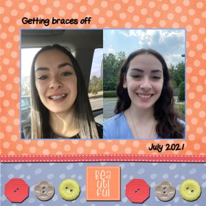 2021-07-07 Naomi Braces off