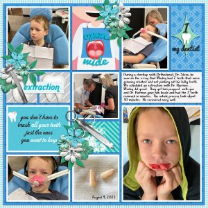Tooth Extractions