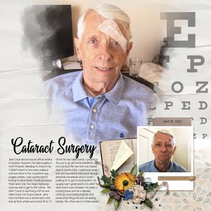 Cataract Surgery