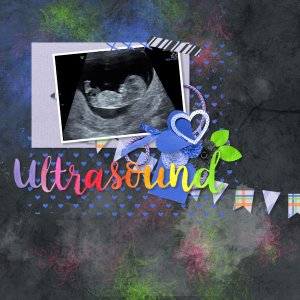 Ultrasound