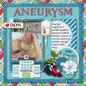 aneurysm