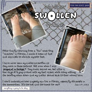 June 2025 - My Swollen Ankles.jpg