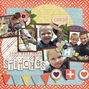 Stitches