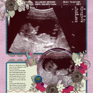 Lexi ultrasound pics