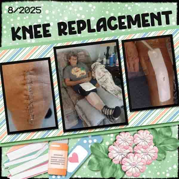 08 Robbin's knee replacement ----- April 2025 -DD_Mental health_edited-1.jpg