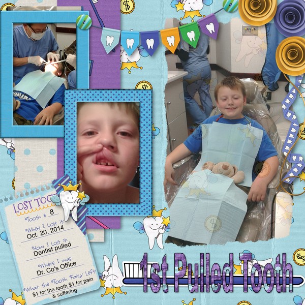 1st Pulled Tooth