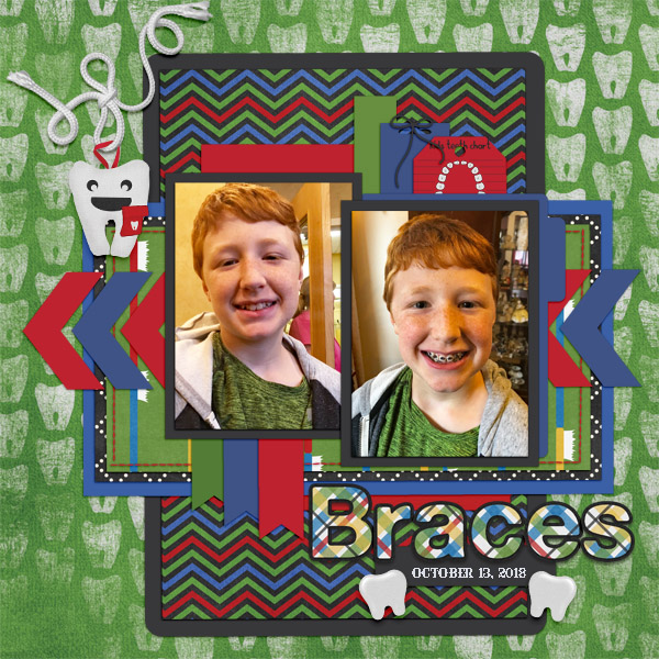 2018 10 Braces