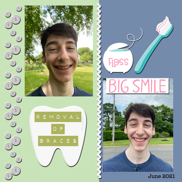 2021-06 Justin Removal of Braces