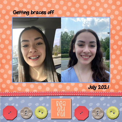 2021-07-07 Naomi Braces off