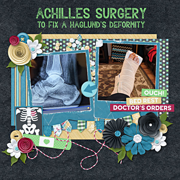 Achilles Surgery