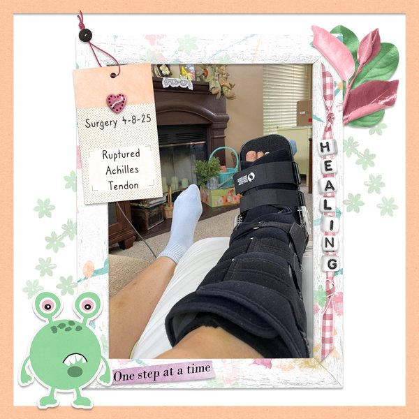Achilles Tendon