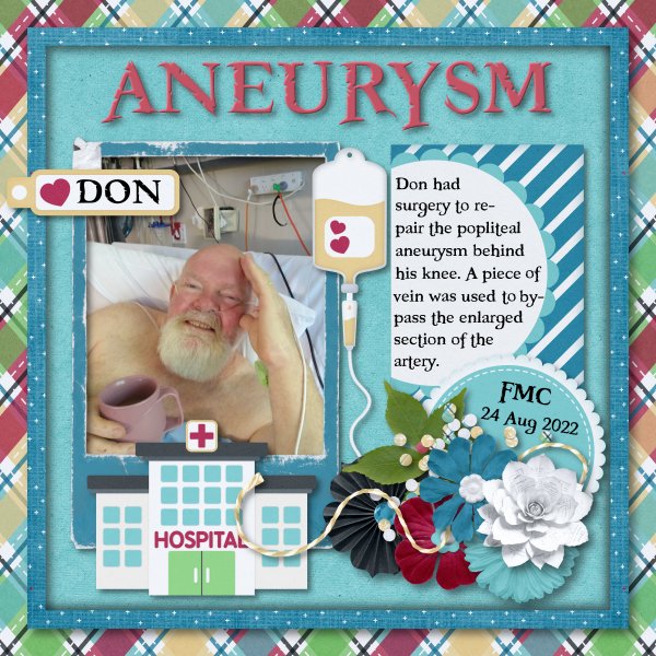 aneurysm