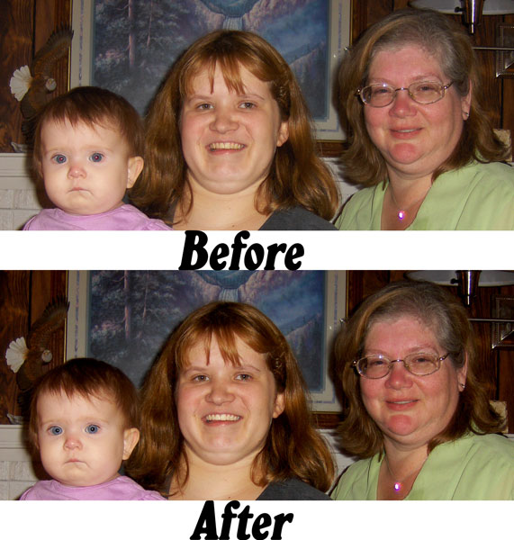 Before and After