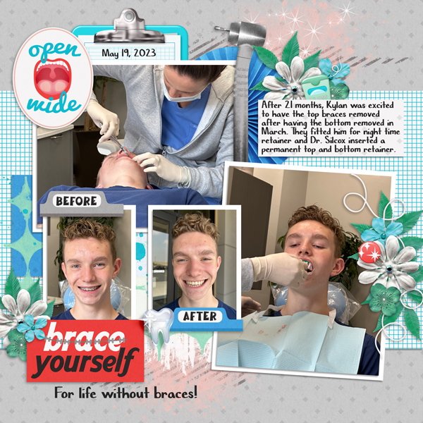 Braces removed