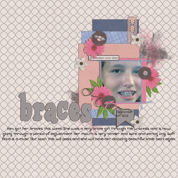braces
