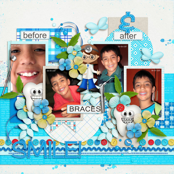 braces