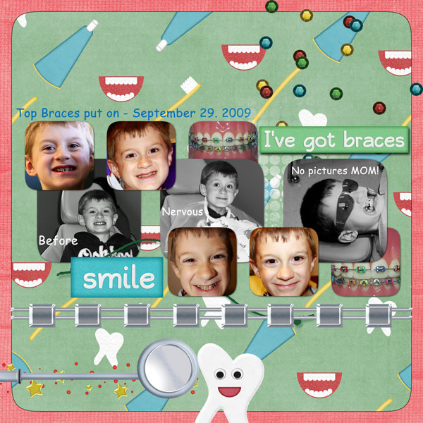 Braces