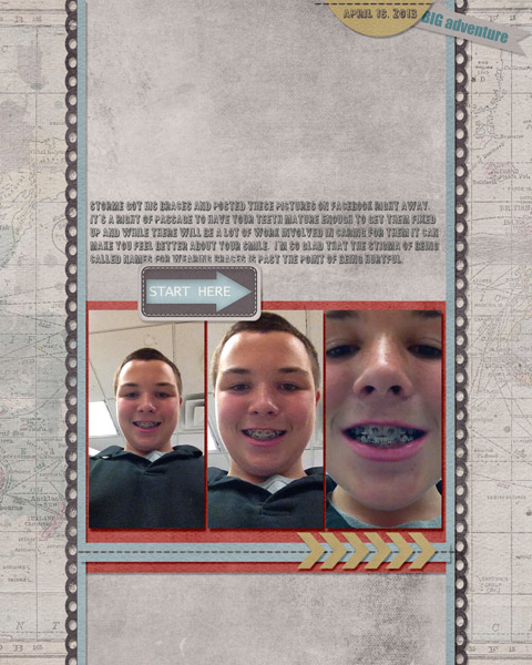 Braces