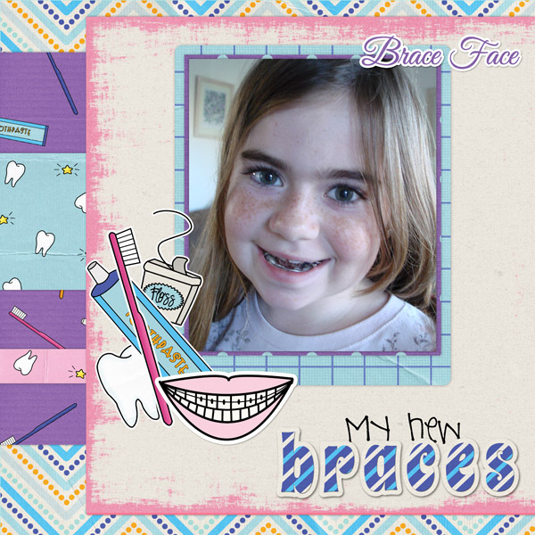 braces_mily