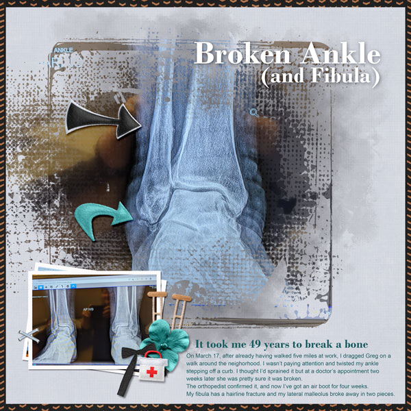 Broke Ankle plus