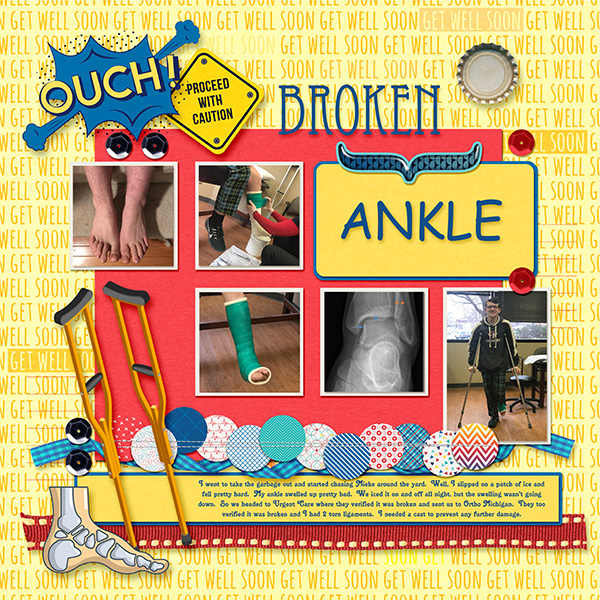 Broken Ankle