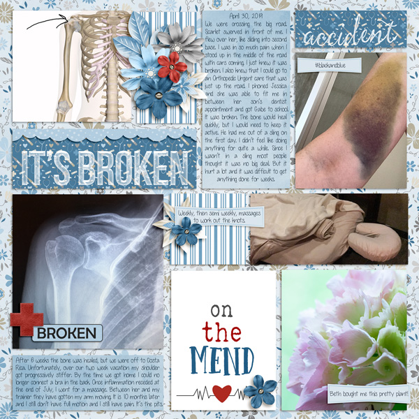 broken arm